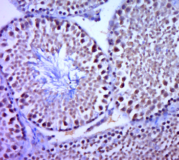 PADI6 Rabbit Polyclonal Antibody