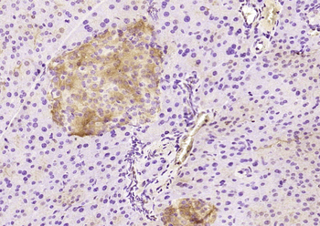 PAFAH2 Rabbit Polyclonal Antibody