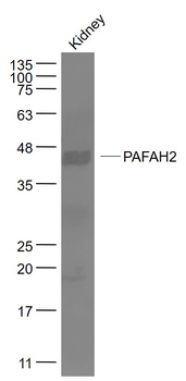 PAFAH2 Rabbit Polyclonal Antibody