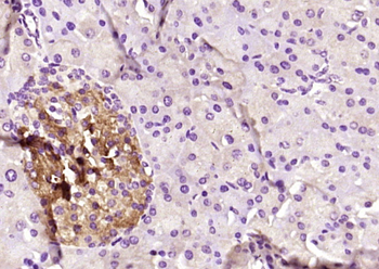 PLRP2 Rabbit Polyclonal Antibody