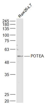 POTEA Rabbit Polyclonal Antibody