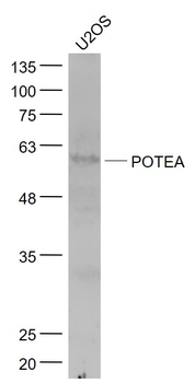 POTEA Rabbit Polyclonal Antibody