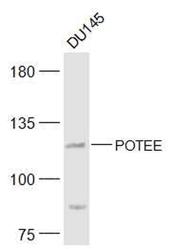 POTEE Rabbit Polyclonal Antibody