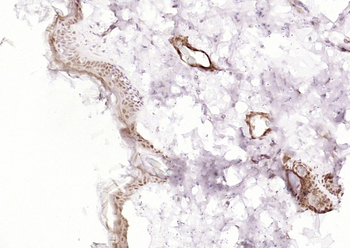 POU2F3 Rabbit Polyclonal Antibody