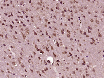 PPM1E Rabbit Polyclonal Antibody