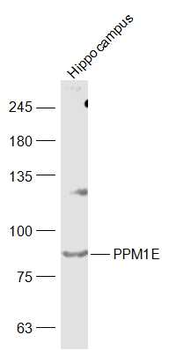 PPM1E Rabbit Polyclonal Antibody
