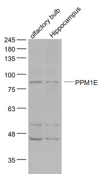 PPM1E Rabbit Polyclonal Antibody