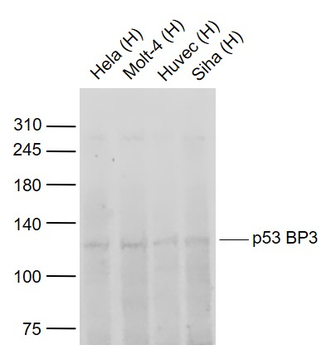 P53 BP3 Rabbit Polyclonal Antibody