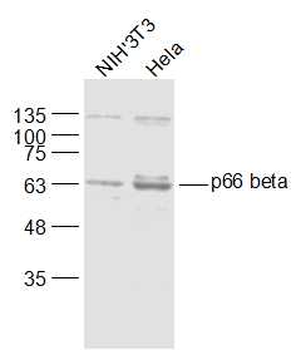 P66 beta/GATAD2B Rabbit Polyclonal Antibody