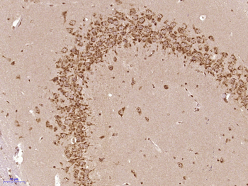 PAPD4 Rabbit Polyclonal Antibody