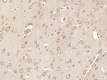 PAPD4 Rabbit Polyclonal Antibody