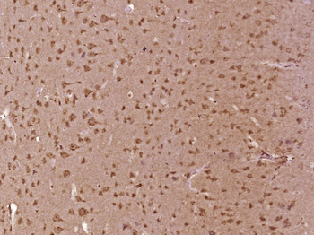 PDE1A Rabbit Polyclonal Antibody