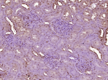 PDE1A Rabbit Polyclonal Antibody