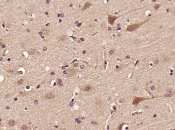 PDE2A Rabbit Polyclonal Antibody