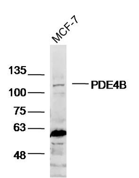 PDE4B Rabbit Polyclonal Antibody