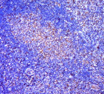 Phospho-PDCD4 (Ser67) Rabbit Polyclonal Antibody