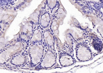 Phospho-PDCD4 (Ser67) Rabbit Polyclonal Antibody