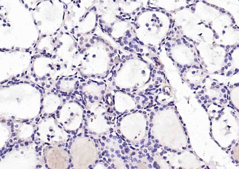 Phospho-PDCD4 (Ser67) Rabbit Polyclonal Antibody