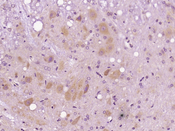 PDIA6 Rabbit Polyclonal Antibody