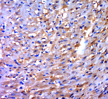 PDLIM2 Rabbit Polyclonal Antibody