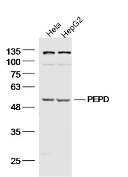 PEPD Rabbit Polyclonal Antibody