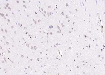 PEX13 Rabbit Polyclonal Antibody