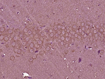 PEX6 Rabbit Polyclonal Antibody