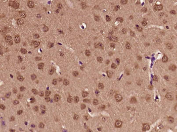 PFDN3 Rabbit Polyclonal Antibody