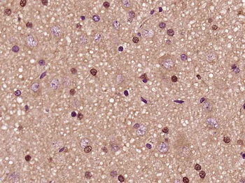 PFKFB3/PFK2 Rabbit Polyclonal Antibody