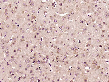 PKC iota Rabbit Polyclonal Antibody