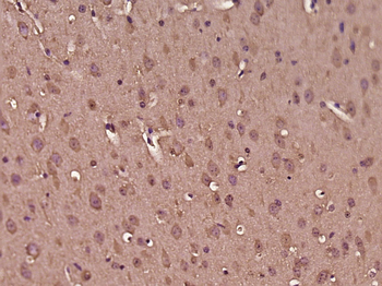 PKIB Rabbit Polyclonal Antibody