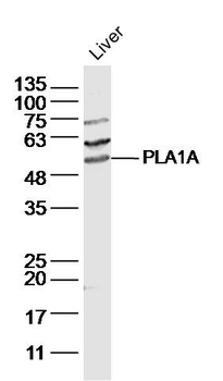 PLA1A Rabbit Polyclonal Antibody