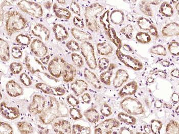 PLA2R Rabbit Polyclonal Antibody