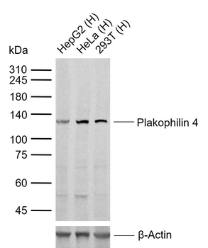 Plakophilin 4 Rabbit Polyclonal Antibody