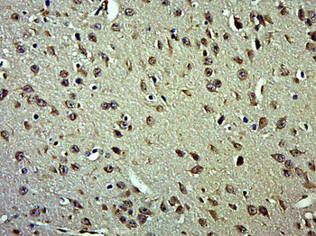 QSER1 Rabbit Polyclonal Antibody