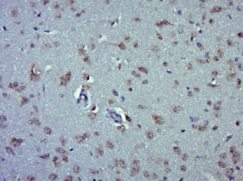 QTRTD1 Rabbit Polyclonal Antibody