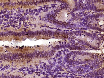R3HDM2 Rabbit Polyclonal Antibody