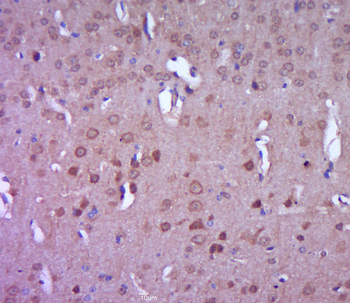 RAB31 Rabbit Polyclonal Antibody