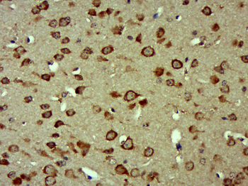 RAB7L1 Rabbit Polyclonal Antibody