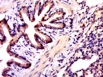 RASGRP4 Rabbit Polyclonal Antibody