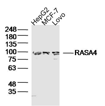 RASA4 Rabbit Polyclonal Antibody