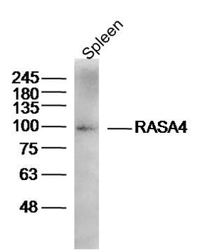 RASA4 Rabbit Polyclonal Antibody
