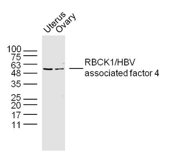 RBCK1 Rabbit Polyclonal Antibody