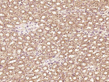 RBM16 Rabbit Polyclonal Antibody