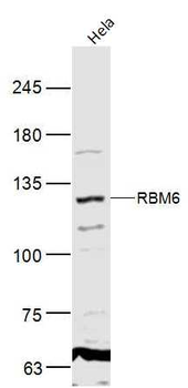 RBM6 Rabbit Polyclonal Antibody