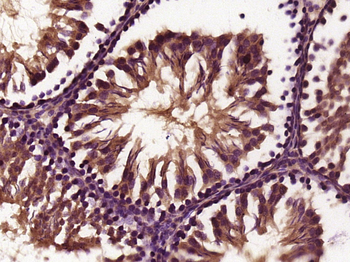 RTL9 Rabbit Polyclonal Antibody