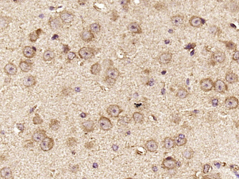 Rho guanine exchange factor 16 Rabbit Polyclonal Antibody