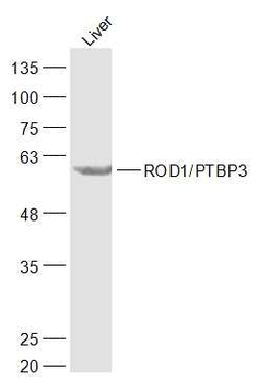 ROD1/PTBP3 Rabbit Polyclonal Antibody