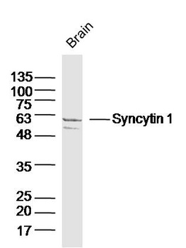 Syncytin 1 antibody