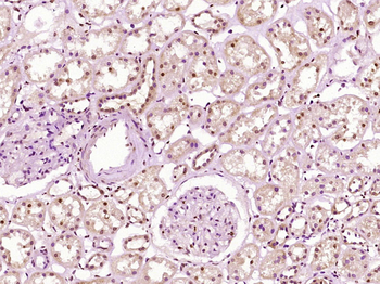 SAP30 Rabbit Polyclonal Antibody